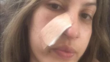 Tiene 27 años y descubrió que tenía cáncer por una limpieza facial