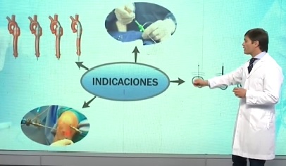 Avances en la medicina: cirugía mínimamente invasiva revoluciona los procedimientos quirúrgicos