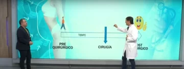 Qué es la cirugía bariátrica y cuáles son sus tres etapas