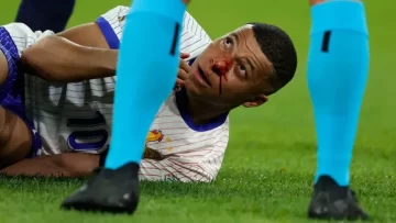 Kylian Mbappé sufrió un duro golpe y se habría fracturado la nariz